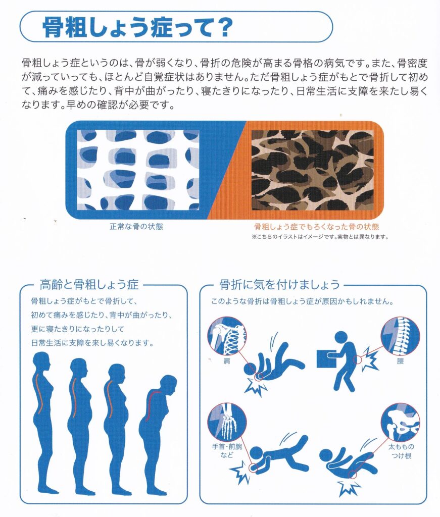 骨粗しょう症って あやせ駅前整形外科 内科公式ページ 足立区 綾瀬 交通事故治療 巻き爪治療 リハビリ